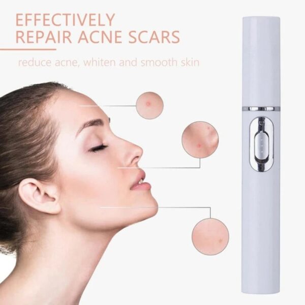 Blue Light Therapy Acne Laser Pen Soft Scar Wrinkle Removal Treatment Device Skin Care Beauty Equipment - Image 8
